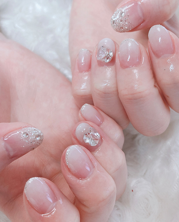 Mさん 30代